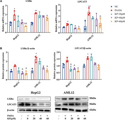 Kaempferol Alleviates Steatosis and Inflammation During Early Non-Alcoholic Steatohepatitis Associated With Liver X Receptor α-Lysophosphatidylcholine Acyltransferase 3 Signaling Pathway